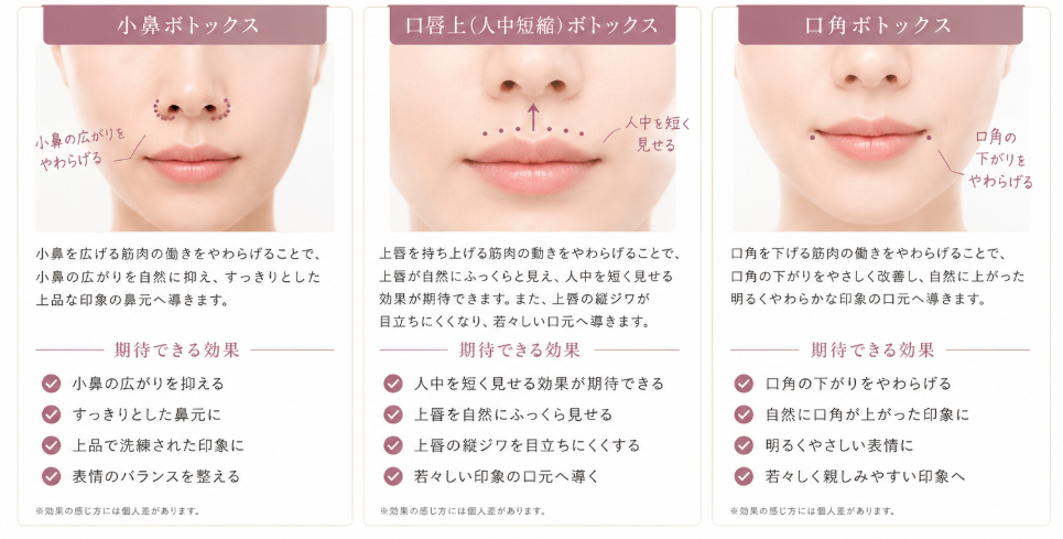 小鼻ボトックス 小鼻の広がりをやわらげる 小鼻を広げる筋肉の動きをやわらげることで、小鼻の広がりを自然に抑え、すっきりとした上品な印象の鼻元へ導きます。 期待できる効果 小鼻の広がりを抑える すっきりとした鼻元に 上品で洗練された印象に 表情のバランスを整える ※効果の感じ方には個人差があります。 口唇上（人中短縮）ボトックス 人中を短く見せる 上唇を持ち上げる筋肉の動きをやわらげることで、上唇が自然にふっくらと見え、人中を短く見せる効果が期待できます。また、上唇の縦ジワが目立ちにくくなり、若々しい口元へ導きます。 期待できる効果 人中を短く見せる効果が期待できる 上唇を自然にふっくら見せる 上唇の縦ジワを目立ちにくくする 若々しい印象の口元へ導く ※効果の感じ方には個人差があります。 口角ボトックス 口角の下がりをやわらげる 口角を下げる筋肉の動きをやわらげることで、口角の下がりをやさしく改善し、自然に上がった明るくやわらかな印象の口元へ導きます。 期待できる効果 口角の下がりをやわらげる 自然に口角が上がった印象に 明るくやさしい表情に 若々しく親しみやすい印象へ ※効果の感じ方には個人差があります。