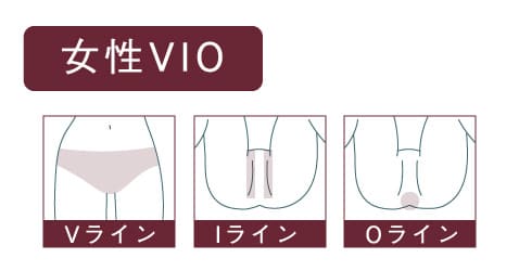 VIO医療脱毛の女性イラスト