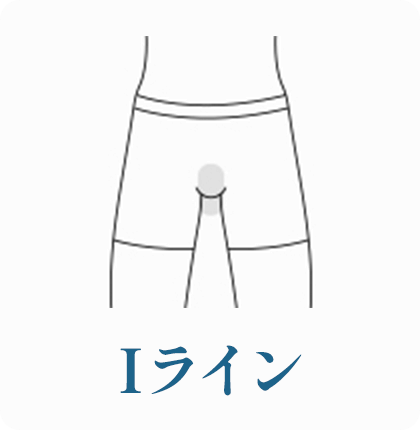 Iライン