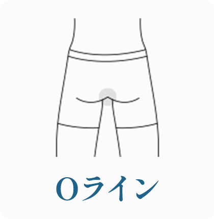 Oライン