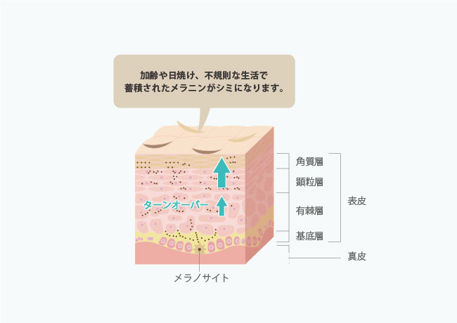 シミができるメカニズム