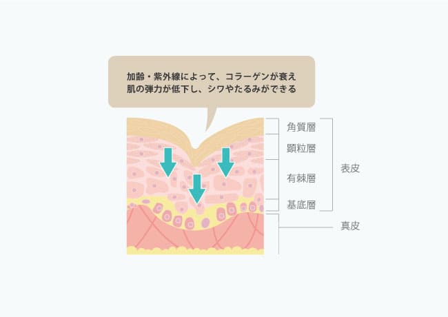 シワはなぜできるのか?